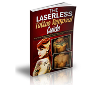 The Laserless Tattoo Removal Guide